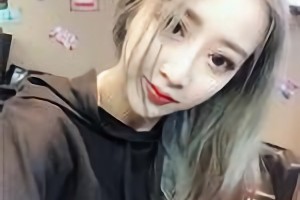 杭州整形醫(yī)院靠譜嗎？附下頜角術后恢復過程圖