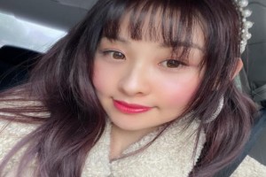 廣州廣大醫(yī)院顴骨內推整形果好不好？附案例展示