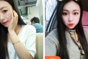 邯鄲市眼科醫(yī)院趙玉霞整形價格表附切開雙眼皮案例展示