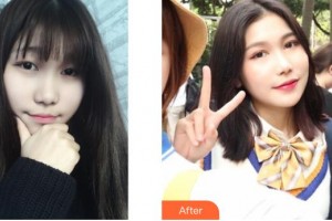 邯鄲愛爾眼科醫(yī)院馬書梅整形價格表附眼部修復案例展示