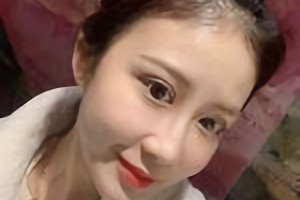 南京醫(yī)科大學(xué)友誼整形外科醫(yī)院怎么樣?附下頜角案例分享