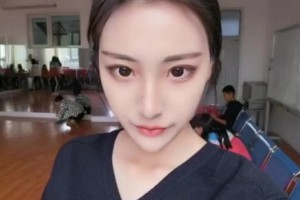 北京圣嘉新醫(yī)院顴骨/術(shù)后恢復(fù)經(jīng)驗(yàn)+較新價(jià)格表