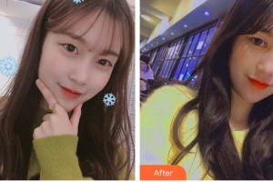 深圳市眼科醫(yī)院羅恒整形價(jià)格表附埋線雙眼皮案例展示