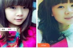 深圳希瑪林順潮眼科醫(yī)院施尼可整形價格表附眼部綜合案例展示