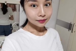 北京麗都醫(yī)療美容醫(yī)院顴弓外擴(kuò)整形果？真實(shí)案例對(duì)比