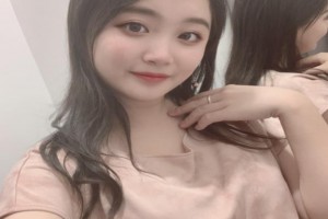 韓國Face-line整形醫(yī)院顴骨整形恢復(fù)果怎么樣附對比圖