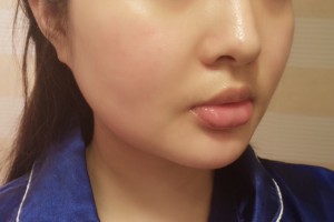 上海首爾麗格整形醫(yī)院切下頜角果附價格表