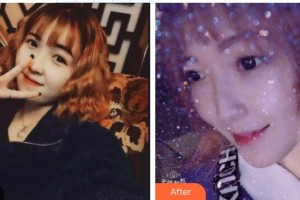 東莞維多利亞整形醫(yī)院李剛整形價格表附超聲波潔牙案例展示