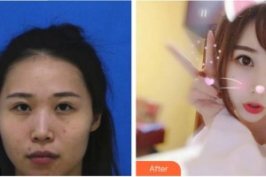 東莞百佳瑪麗亞婦產(chǎn)醫(yī)院蔡強整形價格表附鼻部綜合案例展示