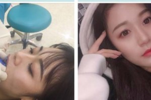 東莞南城固德口腔門診部梁波整形價(jià)格表附牙齒隱形矯正案例展示