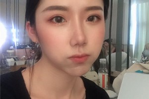 下頜角2021價(jià)格表上海時(shí)光整形醫(yī)院案例分享