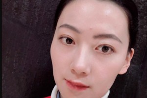 北醫(yī)三院熱瑪吉貴不貴，附術后90天果分享