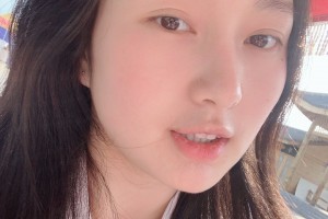 濟(jì)寧附屬醫(yī)院整形科下顎角感覺(jué)怎樣？真人案例圖片對(duì)比