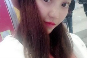 深圳瑞麗斯割雙眼皮果好不好附案例|2021價格表