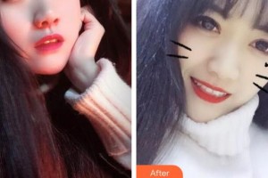 酒泉市口腔醫(yī)院王金禮整形價格表附美白劑美白牙齒案例展示