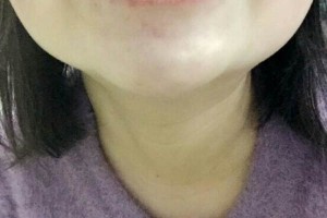 哈爾濱圣安口腔醫(yī)院怎么樣？附牙齒矯正果圖