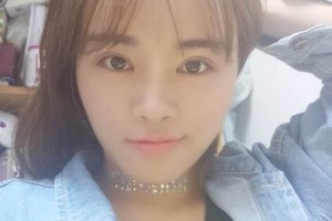 杭州117醫(yī)院整形科主任雙眼皮怎么樣？附果圖展示