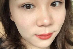 十堰太和醫(yī)院整容科怎么樣雙眼皮附果圖