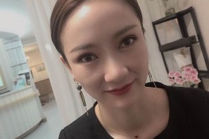 西安友誼醫(yī)院整形科怎么樣割雙眼皮日記分享|價(jià)格表