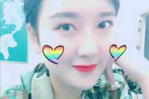 深圳陽光美容醫(yī)院正規(guī)嗎雙眼皮怎么樣？附果圖