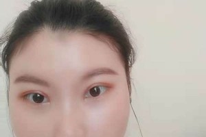 杭州浙二醫(yī)院整形醫(yī)院割雙眼皮果好不好|價(jià)格表