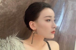 廣州中山大學附屬醫(yī)院植發(fā)怎么樣附果圖