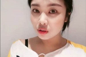 遼寧丹東金澄美容醫(yī)院光子嫩膚果，多久做一次附價格表