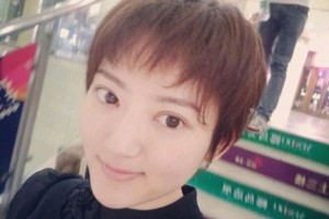 哈爾濱醫(yī)大二院整形美容科雙眼皮？真人案例+醫(yī)生介紹