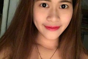 湖南株洲中心醫(yī)院整形科？雙眼皮術(shù)后注意事項！