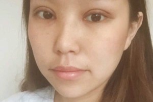 寧波第一院整容科項目好不好？科室醫(yī)生介紹！