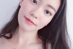 無錫中醫(yī)院整形科如何？雙眼皮成功案例測評分享！