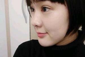 武漢天佑醫(yī)院整形雙眼皮行不行？真人圖片對比+醫(yī)生推薦