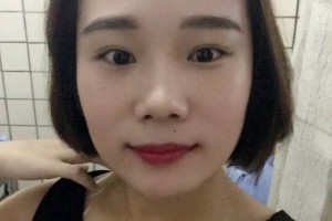 濟(jì)南集美整形醫(yī)院｜雙眼皮真人案例&較新價(jià)格表