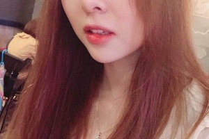 鄭州集美整形醫(yī)院隆鼻真人案例+醫(yī)生介紹！