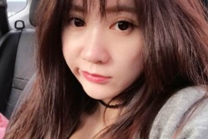 天津一中心整形外科隆鼻怎么樣？真人案例+醫(yī)生介紹