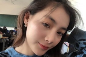 蘇州附二醫(yī)院整形科下頜角術(shù)后果？醫(yī)生推薦&費(fèi)用表