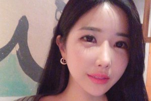 襄陽市中心醫(yī)院整形科下頜角術后果？較新價格表