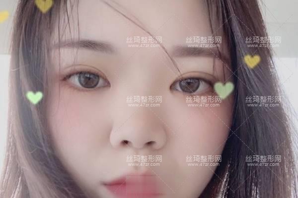 哈爾濱醫(yī)大二院正規(guī)嗎好不好？鼻部手術(shù)價(jià)目表和醫(yī)生推薦