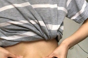 武漢涵美整形醫(yī)院怎么樣？吸脂減肥實拍—術(shù)后恢復(fù)