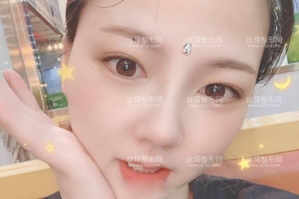 上海生命樹醫(yī)療美容醫(yī)院怎么樣？鼻部手術(shù)價(jià)目表和醫(yī)生推薦