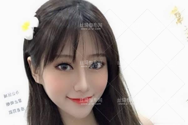 寧波第三醫(yī)院整形美容科怎么樣？鼻部手術(shù)價目表和醫(yī)生推薦