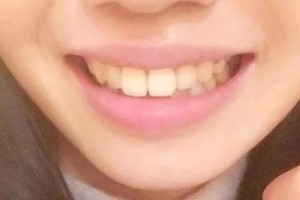 九院正畸科好不好？醫(yī)生名單&2021價(jià)格表