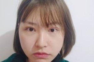 麗港醫(yī)療美容整形醫(yī)院怎么樣？醫(yī)生推薦