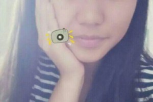 梅州人民醫(yī)院整形科激光嫩膚如何？術(shù)后測(cè)評(píng)-費(fèi)用表