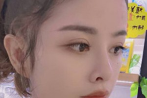 青醫(yī)附院環(huán)境好不好？雙眼皮案例&2021價(jià)格表！