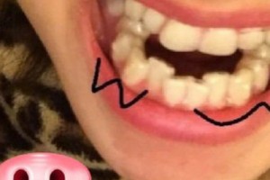 沈陽醫(yī)大正畸比較厲害的醫(yī)生有~全新價(jià)格表