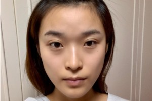 合肥曙光醫(yī)院植發(fā)怎么樣？附2021價(jià)格表