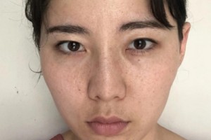 泰安中心醫(yī)院美容科怎么樣/激光祛斑測評點(diǎn)評!