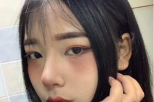 鄭州二附院整形科隆鼻果？手術(shù)案例實(shí)拍