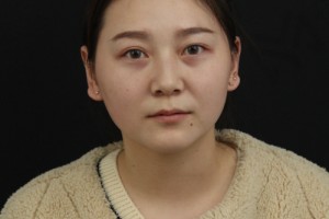 鄭州天后醫(yī)院隆鼻整形正規(guī)嗎？醫(yī)院簡介—醫(yī)生名單